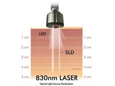 Microlight Smart Laser Cold Laser 3B TRIPLE PROBE DOUBLE PROBE