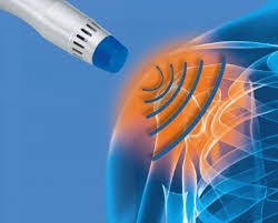 shockwave therapy in sports injury